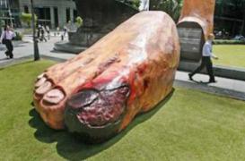 Diabète : 8 000 amputations du membre inférieur par an 