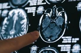 Alzheimer : des chercheurs parviennent à restaurer la mémoire de plusieurs souris