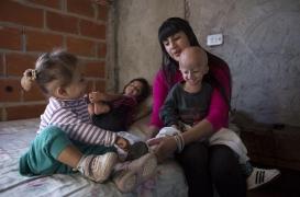 Progéria : les cellules des malades rajeunies en laboratoire