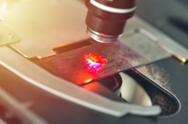 Une nouvelle technique de détection de cancer pourrait bientôt remplacer le prélèvement de tissus 