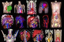 Modélisation 3D : un espoir pour traiter les tumeurs inopérables