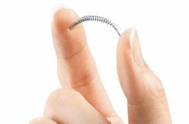 Essure : le Brésil retire du marché l'implant de stérilisation 