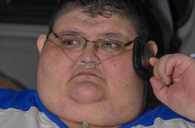 Juan Pedro Franco Salas : il pèse 500 kilos avant son opération