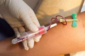 Cancer du poumon : l'espoir d'un test sanguin pour le dépister  