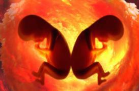 Jumeaux : un père biologique est aussi l'oncle de son fils 