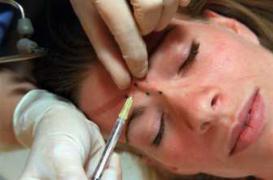 Quand le Botox vous monte à la tête