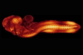 Vidéo : des chercheurs ont réussi à filmer le développement d’un fœtus en temps réel