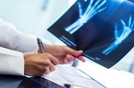 Grève des radiologues : jusqu'à 100 % des cabinets fermés 