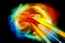 Infarctus : après mise en place d'un stent, il faut un double traitement anti-agrégant pendant 12 mois
