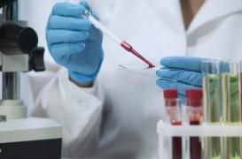 VIH : des chercheurs ont peut-être enfin découvert comment tuer le virus