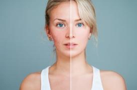 Image corporelle des enfants : les dangers des photos retouchées sur les réseaux sociaux