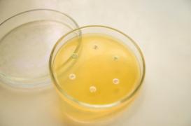 Une Américaine infectée par une bactérie résistante à tous les antibiotiques