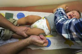 Rougeole : 150 cas en Alsace