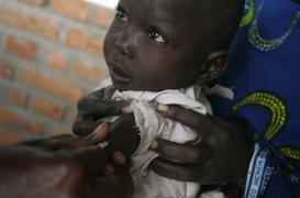 La rougeole frappe durement la RDC