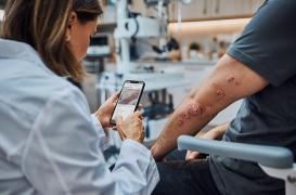 Cette IA peut détecter 300 affections cutanées à partir d'une simple photo