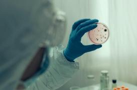 Afrique de l’Ouest : que sait-on du virus de Marburg qui est apparu en Guinée ? 