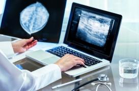 Cancer du sein : 5 millions de participantes au dépistage organisé