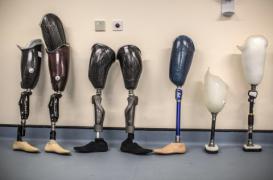 Une prothèse tactile qui estompe les douleurs du 