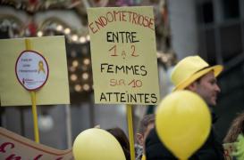 Endométriose : le sperme aggrave la maladie