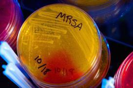 Antibiotiques : une nouvelle technique pour vaincre la résistance des bactéries