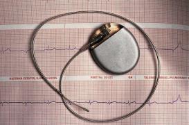 Pacemakers sans fil : premiers résultats encourageants