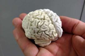 Parkinson : un dispositif de neurostimulation implantable approuvé 