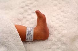 Perturbateurs endocriniens : associés à des malformations génitales