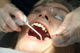 Prendre soin de ses dents pour protéger son coeur