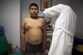  Cancer colorectal : les ados obèses deux fois plus à risque après 50 ans