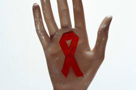 Sida : une campagne virale d'AIDES pour ne pas oublier