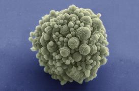 Craig Venter a créé un organisme vivant avec 473 gènes