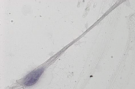 Spermatozoïdes in vitro : encore un long chemin pour les chercheurs lyonnais