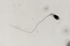 Des chercheurs français auraient conçu des spermatozoïdes in vitro