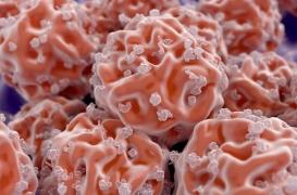 Don de moelle osseuse : recherche donneurs masculins désespérément !