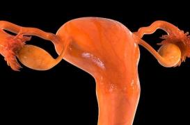 Une nouvelle association annonce une révolution dans le traitement des cancers de l’ovaire