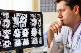 Cerveau : un cocktail vitaminé pour retarder le vieillissement 