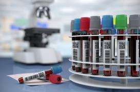 Cholestérol : les Français connaissent mal les risques