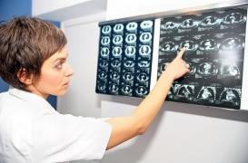 Tabagisme : subir un scanner de dépistage aide à se sevrer