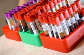 Méningocoque: deux décès  qui bouleversent les enseignants