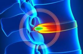 Un nouveau traitement minute contre le mal de dos 