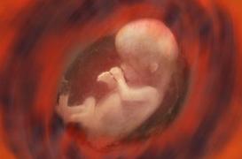 Inde : un bébé naît avec une tête dans son estomac 