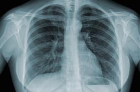 Cigarettes : un paquet par jour provoque 150 mutations génétiques par an