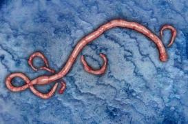 Ebola : le virus laisse des lésions sur la rétine des survivants