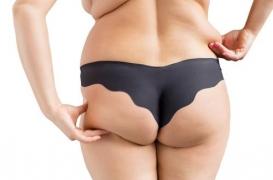 6% des cancers sont liés au surpoids et au diabète, surtout chez les femmes