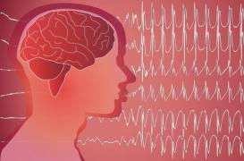 Un dérivé du cannabis permet de réduire les crises d'épilepsie résistantes