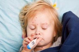 Epidémie de rougeole : les signes d'alerte et comment l’éviter ?