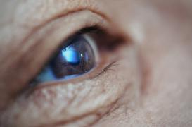 DMLA : la piste prometteuse des thérapies géniques