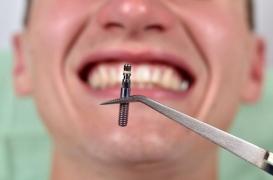  L’ANSM retire du marché des implants dentaires