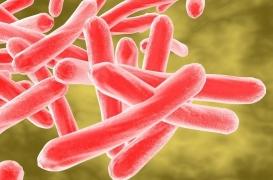 Tuberculose pulmonaire : un étudiant infecté peut contaminer 10 à 15 personnes