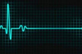 Que se passe-t-il dans le cerveau au moment de la mort ?